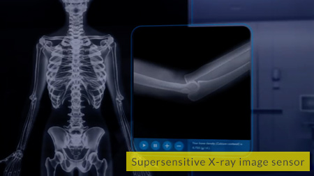 Supersensitivity X-ray image sensor